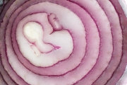 Onion 6
